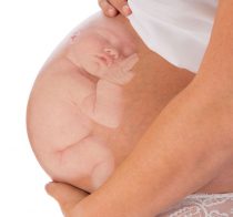 TULISAN 30. BAYI LAHIR PANTAT DULUAN